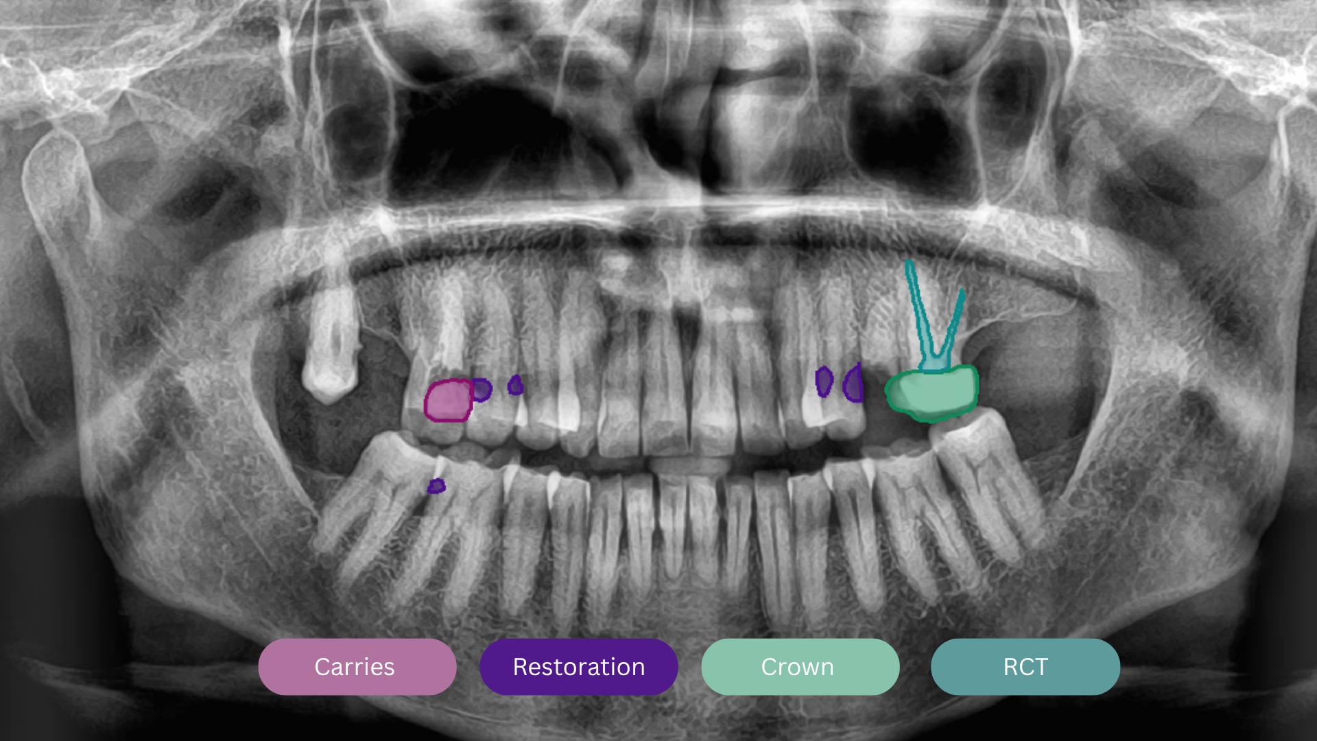Future of Healthcare